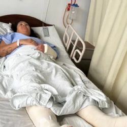 Buscan repatriar a una argentina que cayó de un tercer piso en México 