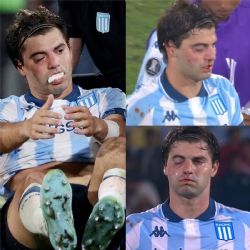Marcos Rojo fracturó a Santi Sosa y así quedó el futbolista de Racing