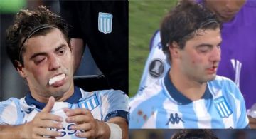 Marcos Rojo fracturó a Santi Sosa y así quedó el futbolista de Racing