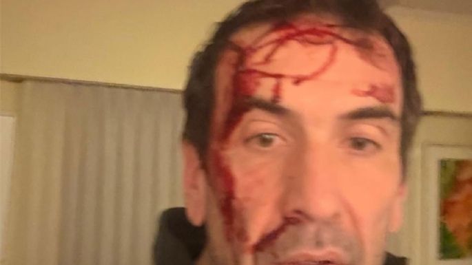 El diputado por Neuquén Pablo Cervi, víctima de un violento asalto: le gatillaron