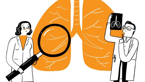 En lo que va del año se notificaron más de 13.000 casos de tuberculosis en Argentina