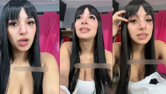 Una influencer afirma que fue atacada a la salida de un boliche por linda 