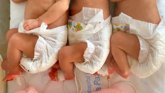 Nacieron trigemelas, un caso que se da en 100 millones de nacimientos