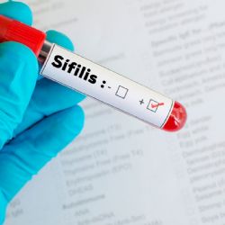En 2025 se registraron más de 50 mil casos de sífilis en Argentina