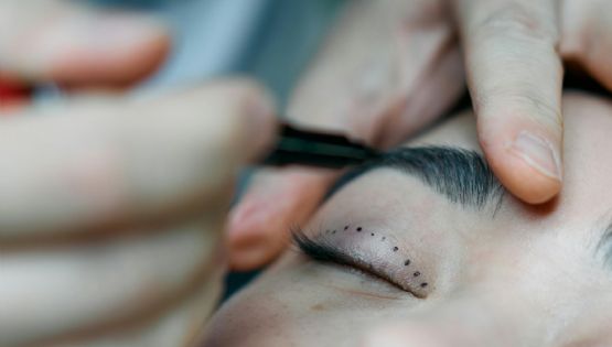 Creció el número de jóvenes que se someten a cirugías faciales