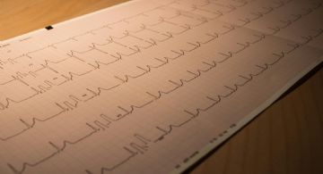 Nueva droga para el tratamiento del infarto de miocardio