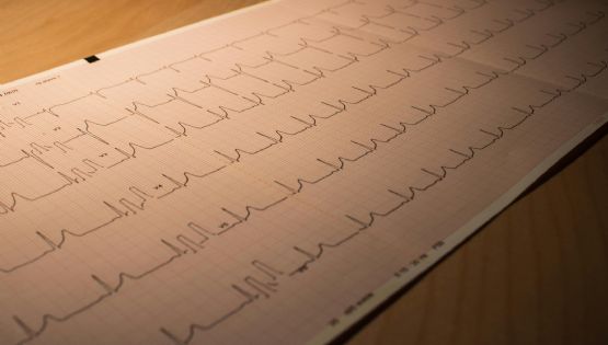 Nueva droga para el tratamiento del infarto de miocardio