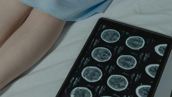 Cáncer renal: detectado a tiempo, puede tratarse