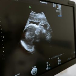 Cómo afecta la calidad de vida en la posibilidad de tener hijos