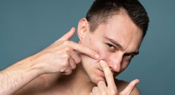 Levadura, un aliado natural contra el acné