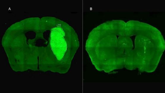 Científicos del CONICET logran neutralizar un tumor agresivo