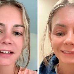 Se “reventó” un grano en el triángulo de la muerte y terminó en una guardia médica 