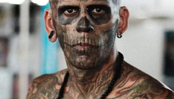El hombre "más tatuado del mundo" mostró su rostro tras realizarse un tratamiento con laser 