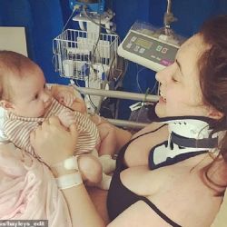 Una mujer bostezó tan fuerte que se quebró el cuello 