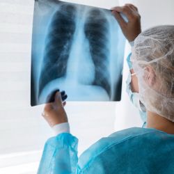 Las últimas novedades sobre avances en fibrosis quística 