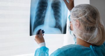 Las últimas novedades sobre avances en fibrosis quística 