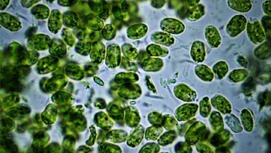 Alerta por la aparición de cianobacterias en la Plata