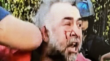 Foto iliustrativa de  Video: así fue la agresión de la Policía Federal a un camarógrafo de A24