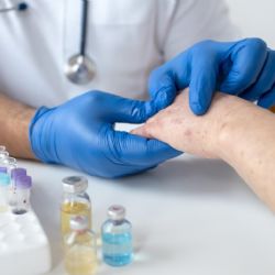 Preocupante: en 2025 hubo más de 46.000 casos de sífilis en Argentina