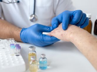 Preocupante: en 2025 hubo más de 46.000 casos de sífilis en Argentina