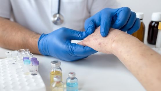 Preocupante: en 2025 hubo más de 46.000 casos de sífilis en Argentina