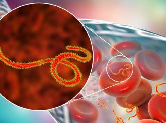 Activan protocolos por ébola en Argentina por embarcaciones provenientes de zonas de riesgo 