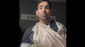 Foto ilustrativa de la nota titulada: Un joven llegó fracturado al Hospital Central y le pidieron que vuelva el lunes