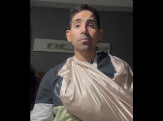 Un joven llegó fracturado al Hospital Central y le pidieron que vuelva el lunes